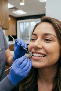 Clear Braces cerámicos discretos colocados en los dientes de un paciente.