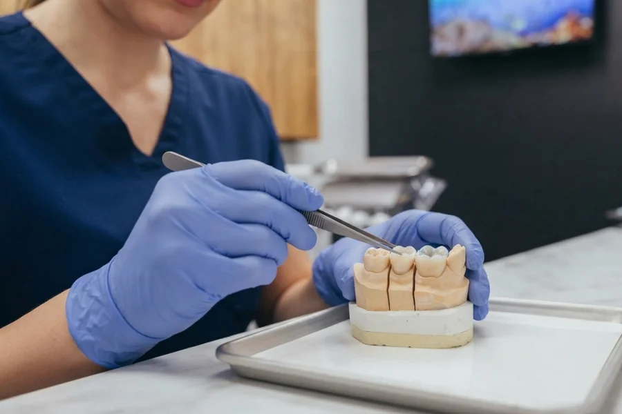 Diferencia visual entre una restauración dental inlay y una onlay